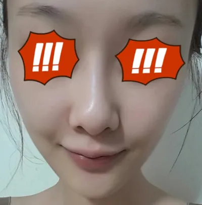 Сар орчмын өмнө өөх шилжүүлэн суулгах хагалгаа хийлгэсэн Сон Ми байна. Бүгд сайн байна уу?