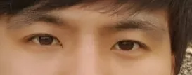 Сайн байна уу^^ Эйпекс-д хагалгаагүй нүдний хэлбэр засуулсан Жунсог байнаа~~