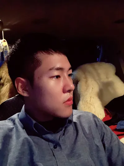 Эрэгтэй хүний хамар заслын дараах сэтгэгдэл