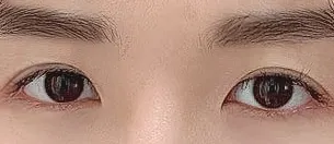 Хиам шиг давхар зовхитой байсан, Чой Дун Ил эмчид маш их баярлалаа