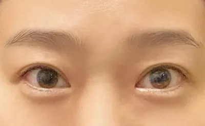 Байгалийн наалдац