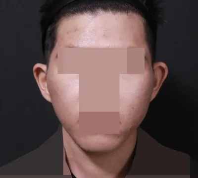 Нүүрний хэлбэр өөрчлөгдөж байгаа нь харагдаж байна