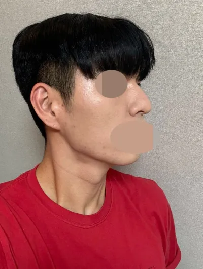 Маш ердийн, төрөлхийн юм шиг харагдаж байгаа болохоор хүмүүс их асууж байна.