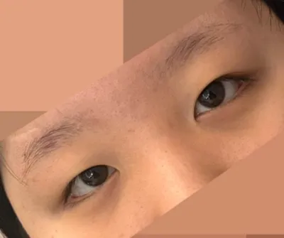 Давхрааны наалт хэрэглэж байгаад амар амьдрахыг хүссэн тул сонгосон!