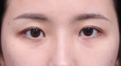 Эртхэн мэдээд хийлгэсэн бол ямар их хэрэгтэй байсан бэ гэж л бодогдож байна!