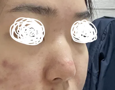 Үр дүн нь үнэхээр гайхалтай, миний авчирсан зурагтай яг адилхан болгоод өгчихлөө ㅠㅜ