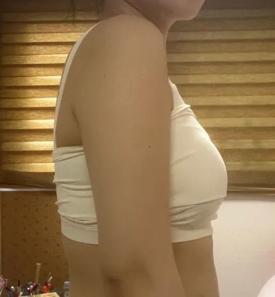 Ваа... хоёр суганы хажуу талын өөхнүүд зүгээр л алга болчихлоо..! Маш их сэтгэл хангалуун байна ㅠㅠㅠ