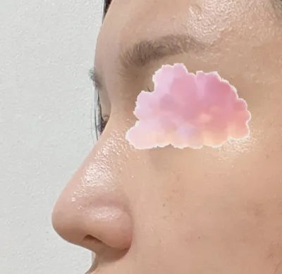 Одоог хүртэл гоо сайхны хагалгаа хийлгэж байхдаа ингэж анхаарал халамж тавьдаг эмнэлэг анх удаа харж байна