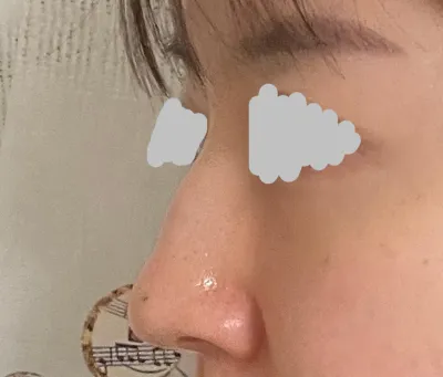 Тайлбар маш эелдэг өгсөн, хагалгаа ч маш сайн болсонд сэтгэл хангалуун байна!