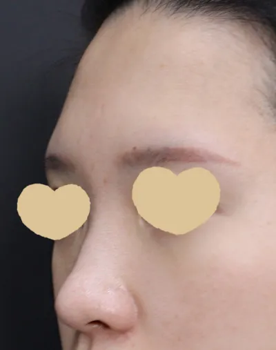 Анхны хамрын хагалгаагаа хийлгэхээр сонгосон эмнэлэг маань моделийг нь хараад шууд л таалагдсан Вери Гүүд гоо сайхны мэс заслын эмнэлэг байлаа:)