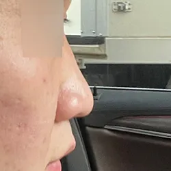 Намхан бөгөөд өргөн хамар минь миний сул тал байсан ч, хагалгаа хийлгээд удаагүй байгаа гэхэд аль хэдийн сэтгэл хангалуун байна.