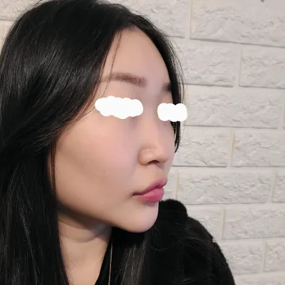 Гоё хамар хийж өгсөн Им Ён-мин захирал, хамрын салстын үрэвслийг (ринит) эмчилж өгсөн Нам Жэ-сон захирал нартаа баярлалаа~