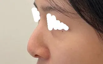 Яагаад эртхэн хийлгээгүй юм бол оо ㅠㅠ Арай эрт хөөрхөн болох байж ㅜㅜ