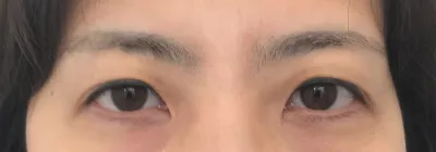 Хүмүүс төрх чинь өөрчлөгдөж гэж хэлээд, аль эмнэлэг, ямар захирал болохыг байнга асууж байна ㅎㅎ