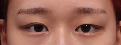 Эмнэлгийн дотор тал цэвэрхэн, бүгд найрсаг болохоор зөвлөгөөнөөс эхлээд хагалгаа, дараах арчилгаа хүртэл ямар ч дарамтгүй хийлгэсэн юм шиг байна.