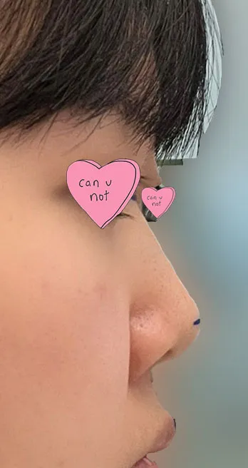 Им Ён Мин захиралд итгээд хагалгаа хийлгэсэн маань зөв сонголт байжээ, маш их санал болгож байна!