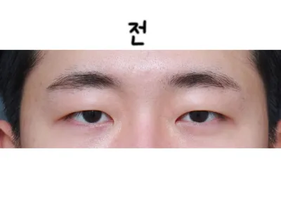 Пак Сан Уг захиралд хагалгаа хийлгээд 5 сар гаруй болж байна.