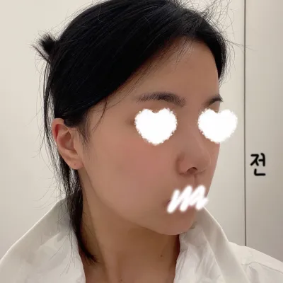 Very Good гоо сайхны эмнэлэгт хийлгээд 5 сар болж байна хх