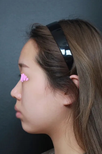 Зөвлөгөөнөөс эхлээд хагалгаа хүртэл маш нарийн тайлбарлаж, найрсаг хандсан болохоор үнэхээр сайхан байсан ㅠㅠ