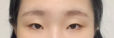 Удаан хүлээсэн давхрааны хагалгаагаа эцэст нь хийлгэлээ..