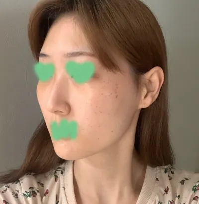 Олон жил шаналгасан комплекс маань хэдхэн хоногийн дотор алга болсонд маш их баяртай байна. Үнэхээр хүчтэй санал болгож байна!!