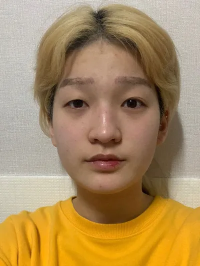 Хагалгаа хийлгээд 4 сар боллоо, нүүрээ будах шаардлагагүй болсон!!