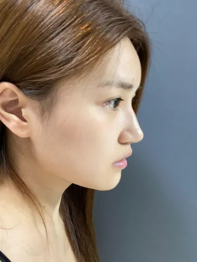 Им Ён Мин захиралтай хагалгааны өмнөх болон дараах зургийг харж, хагалгаа үнэхээр сайн болсон гэж ярилцаад ирлээ кк.