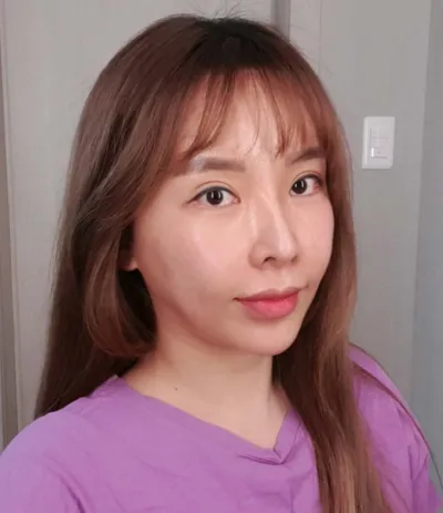 Цээж, давхар эрүүний өөх соруулах, нүүрэндээ бүтэн өөх шилжүүлэн суулгах болон лифтинг хийлгэсэн.