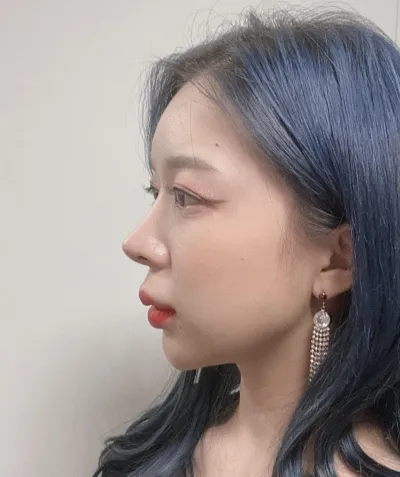 Very Good-д шонхор хамар засуулаад 9 сар болсон сэтгэгдэл!