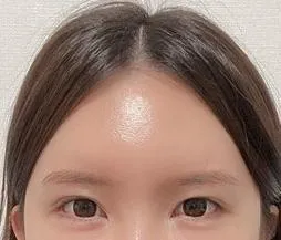 Дух татах хагалгааны 4 сарын дараах сэтгэгдэл байна~~