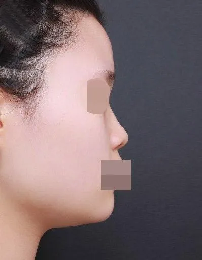 Хамарны хагалгаанд ороод нэг сар болсон сэтгэгдэл байна.