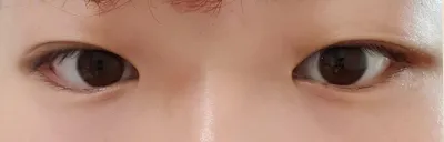 "Very Good" гоо сайхны эмнэлгийн Сон Вон Иль эмчийн талаарх сэтгэгдэл байна.