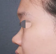 Им Ён Мин эмчдээ маш их баярлалаа~ Надтай адилхан асуудалтай байгаа хүмүүст идэвхтэй санал болгомоор байна~^^