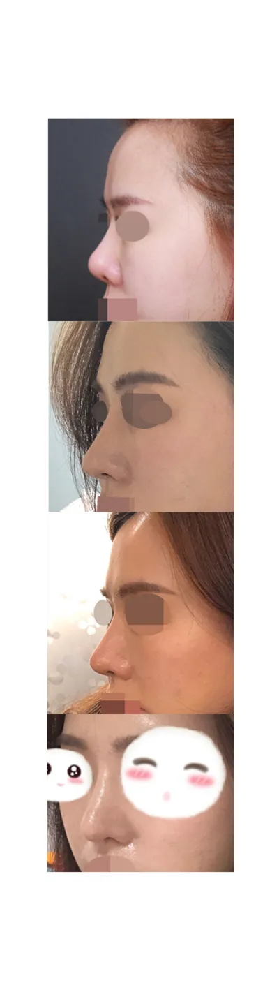 Эргэн тойрныхон маань төрөлхийн юм шиг харагдаж байна, хамаагүй дээр болсон байна гэж их хэлж байгаа.