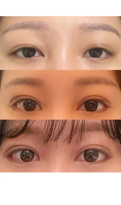 Гурван долоо хоногийн дараах сэтгэгдэл байна хэхэ.