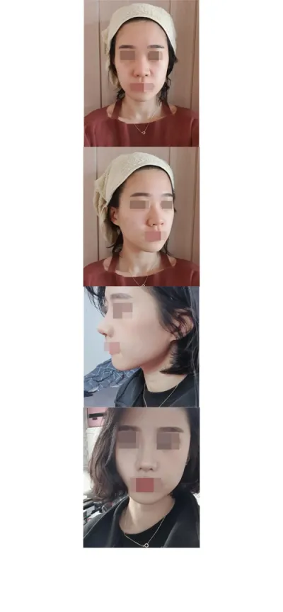 Хамар битүүрэхээс бусдаар бол маш сайн байсан!