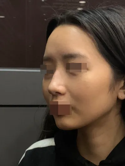 Very Good-д анхны хамрын хагалгаагаа хийлгэлээ.! Very Good!