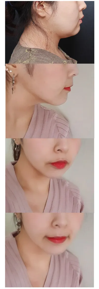 Цаашид ч сайн арчлах болно!! Ерөнхий эмчдээ баيارлалаа!!