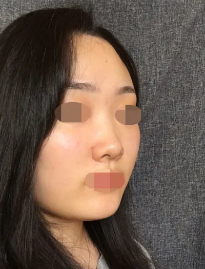 Ерөнхий эмч маань засах шаардлагатай зүйлсийг бодитойгоор хэлж өгч, загварын талаарх асуултад боломжгүй зүйлсийг ч урьдчилан хэлж, үнэн зөв зөвлөгөө өгсөн нь бүр илүү таалагдсан.