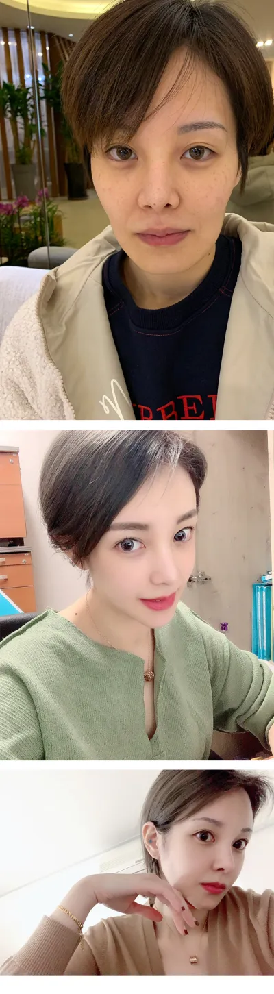 Аль хэдийн 1 жил шахуу болж байна. Нүүрний хэлбэр жаахан тэгш бус байсан нь ч их дээрдсэн ㅋㅋ Нүүрний шугам сайжирсан болохоор селфи ч сайн авч байгаа ㅋㅋㅋ