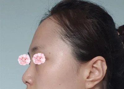 Менежер болон ерөнхий эмч хоёулаа маш найрсаг, хамрын нуруу болон үзүүр ч бас маш их таалагдаж байна!!