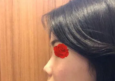 Өөр эмчээр мэс засал хийлгэсэн бол хэзээ ч ийм өндөр болохгүй байсан байх гэж бодохоор огт харамсахгүй байна~~!!