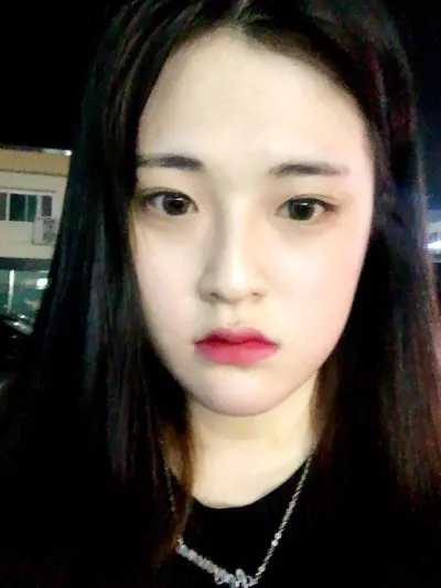 Маш их жаргалтай байна~~~ Мэс засал хийлгээд 6 сар болж байна, одоо бол ихэнх хүмүүс мэс засал хийлгэснийг маань мэдэхгүй байгаа шүү ~