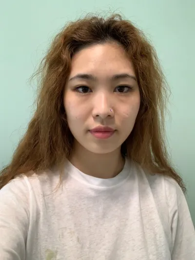 Вери Гүүд-эд нүд, хамар, нүүрний хэлбэр засах хагалгаа хийлгэлээ. Сэтгэгдлээ үлдээж байна~~~!!