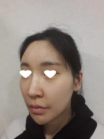 Шанаа багасгах хагалгаа маш төрөлхийн юм шиг болсонд сэтгэл хангалуун байна^^