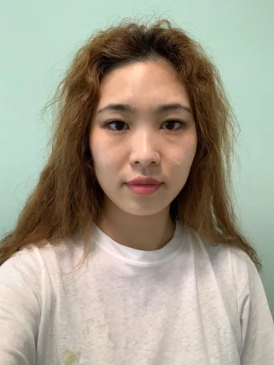 Нүд, хамар, дөрвөлжин эрүү багасгах хагалгааны сэтгэгдэл~~