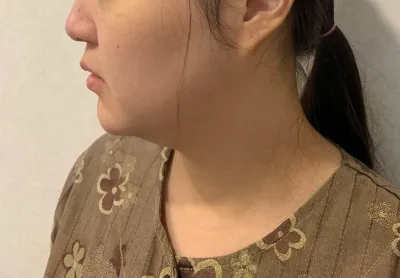 Хагалгааны дараах арчилгааг маш найрсаг сайн хийж өгсөнд сэтгэл хангалуун байна!!