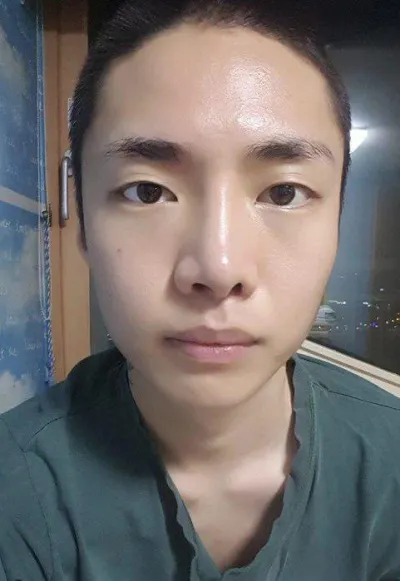 Сайн байна уу~~ Нүдний хагалгаа болон хамрын дахин хагалгааны сэтгэгдэл байна!!