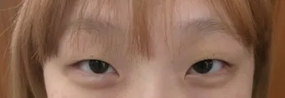 Хагалгаа хийлгээд 3 сар орчим болж байна, хаван нь бага багаар бууж хэлбэрээ олж байх шиг байна!!