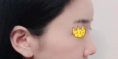 Хамрын дахин хагалгаа хийлгээд 3 сар болж байна^^